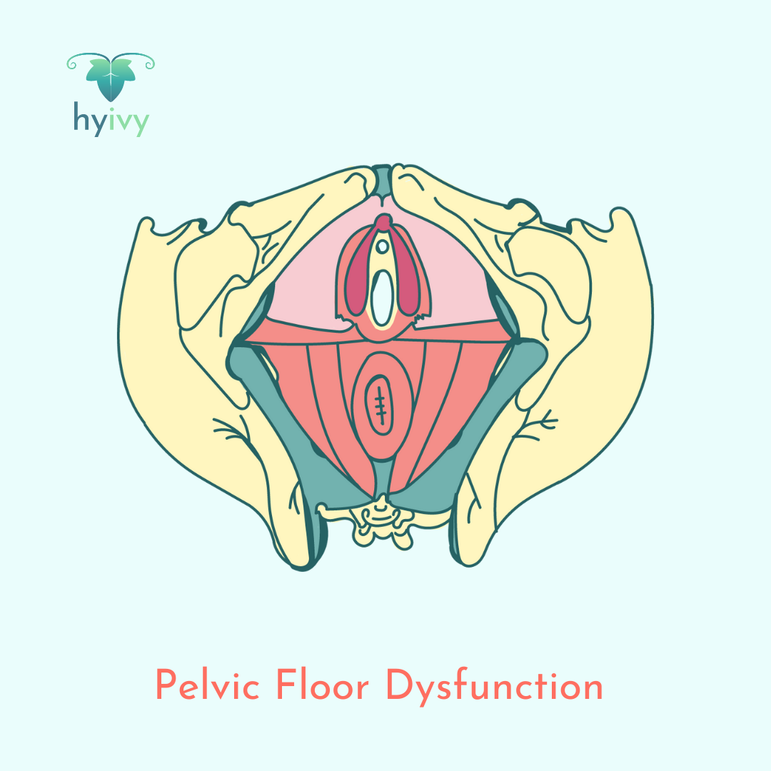 Pelvic Floor Dysfunction 