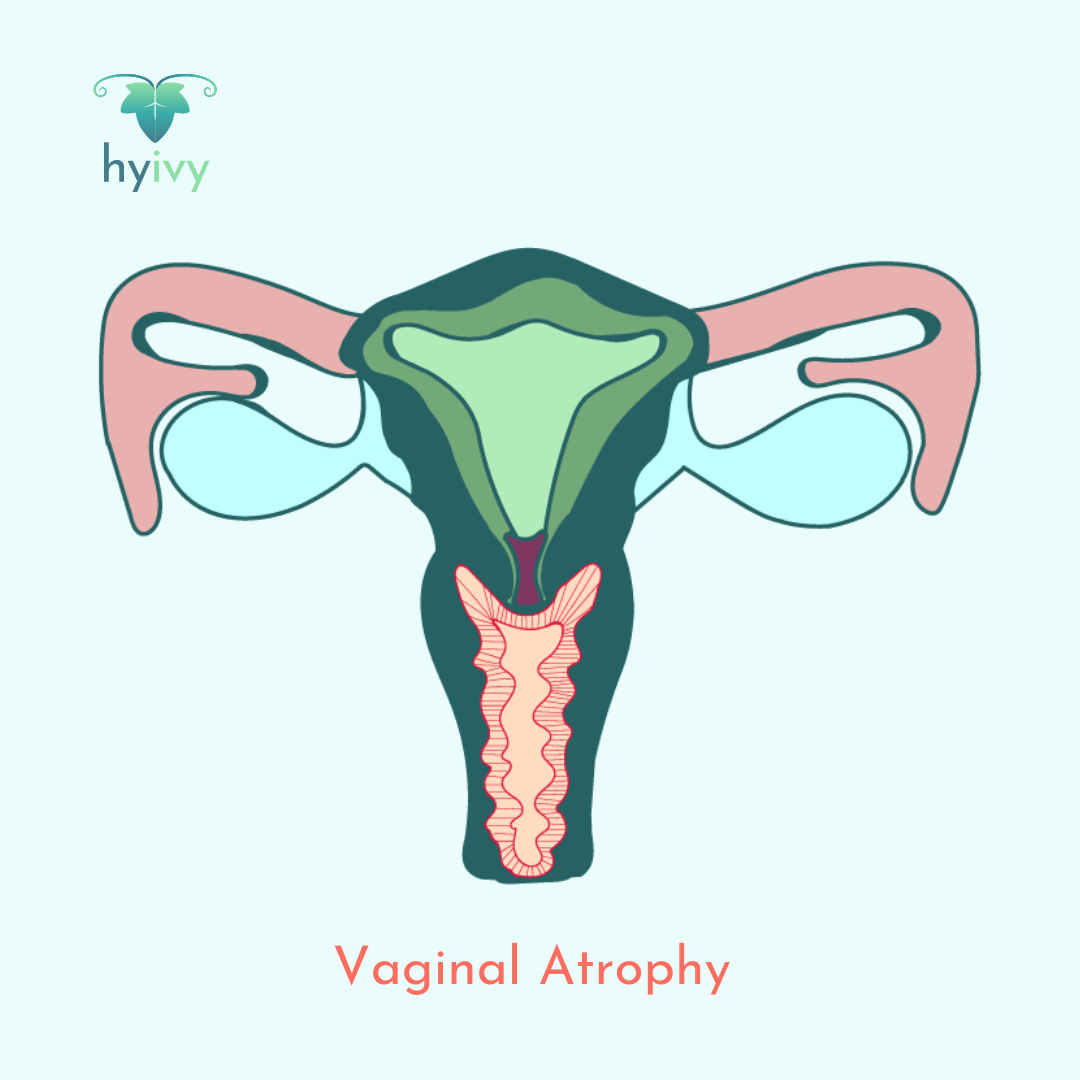Vaginal Atrophy
